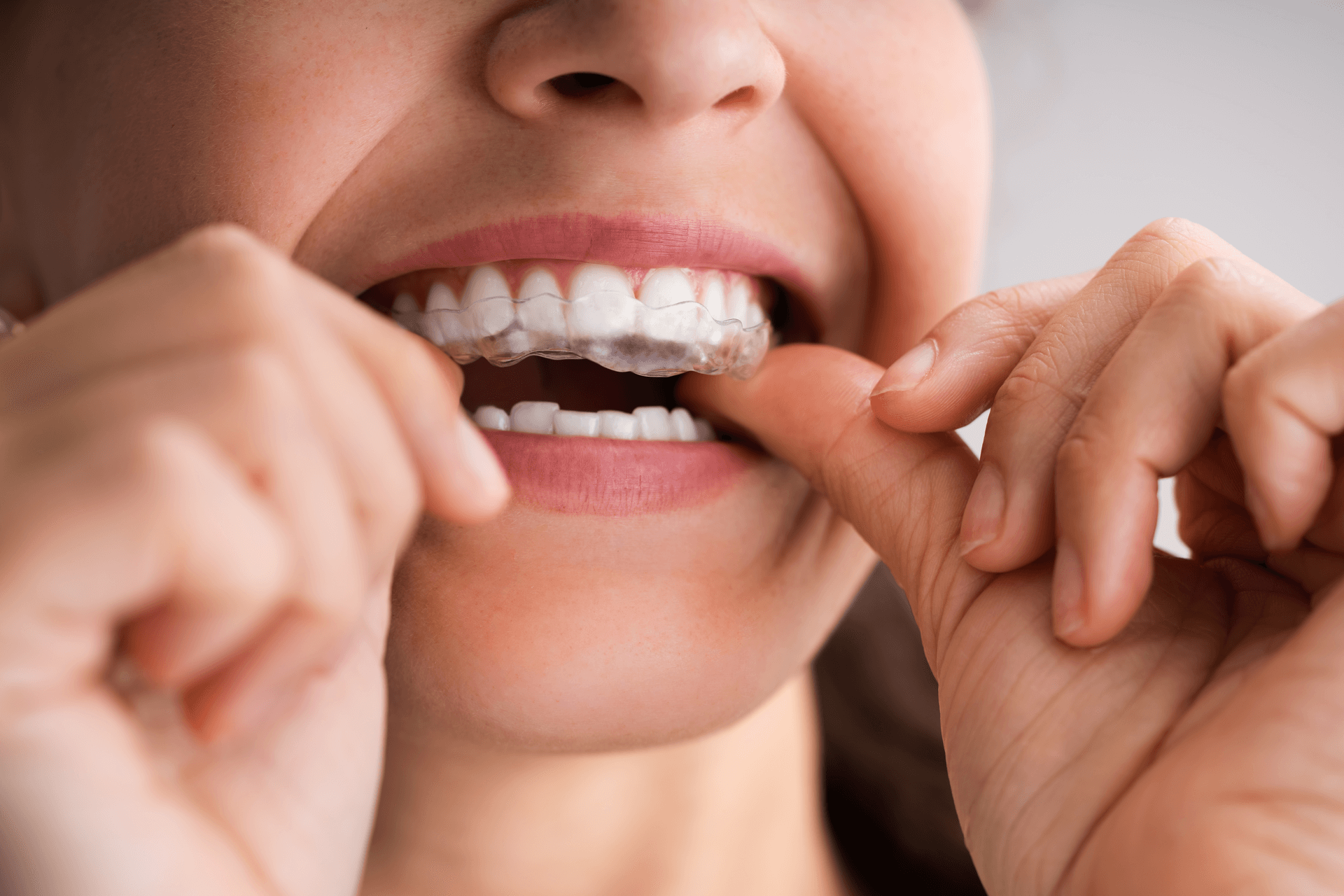 Zähneknirschen im Schlaf: Das können Sie dagegen tun
